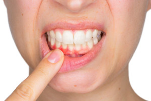 Parodontologie - Dentiste - Casablanca